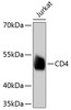 Western blot analysis of extracts of Jurkat cells, using CD4 antibody (13-802) .<br/>Secondary antibody: HRP Goat Anti-Rabbit IgG (H+L) at 1:10000 dilution.<br/>Lysates/proteins: 25ug per lane.<br/>Blocking buffer: 3% nonfat dry milk in TBST.