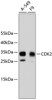Western blot analysis of extracts of various cell lines, using CDK2 antibody (13-811) .<br/>Secondary antibody: HRP Goat Anti-Rabbit IgG (H+L) at 1:10000 dilution.<br/>Lysates/proteins: 25ug per lane.<br/>Blocking buffer: 3% nonfat dry milk in TBST.