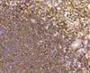 Immunohistochemistry of paraffin-embedded human spleen using CCR7 antibody (13-816) at dilution of 1:100 (40x lens) .