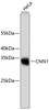 Western blot analysis of extracts of HeLa cells, using CNN1 antibody (13-818) .<br/>Secondary antibody: HRP Goat Anti-Rabbit IgG (H+L) at 1:10000 dilution.<br/>Lysates/proteins: 25ug per lane.<br/>Blocking buffer: 3% nonfat dry milk in TBST.