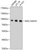 Western blot analysis of extracts of various cell lines, using beta Catenin antibody (13-826) .<br/>Secondary antibody: HRP Goat Anti-Rabbit IgG (H+L) at 1:10000 dilution.<br/>Lysates/proteins: 25ug per lane.<br/>Blocking buffer: 3% nonfat dry milk in TBST.