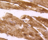 Immunohistochemistry of paraffin-embedded mouse skeletal muscle using DES antibody (13-827) at dilution of 1:100 (40x lens) .