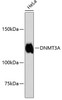 Western blot analysis of extracts of HeLa cells, using DNMT3A antibody (13-832) .<br/>Secondary antibody: HRP Goat Anti-Rabbit IgG (H+L) at 1:10000 dilution.<br/>Lysates/proteins: 25ug per lane.<br/>Blocking buffer: 3% nonfat dry milk in TBST.