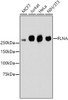 Western blot analysis of extracts of various cell lines, using FLNA antibody (13-840) .<br/>Secondary antibody: HRP Goat Anti-Rabbit IgG (H+L) at 1:10000 dilution.<br/>Lysates/proteins: 25ug per lane.<br/>Blocking buffer: 3% nonfat dry milk in TBST.