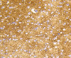 Immunohistochemistry of paraffin-embedded mouse brain using HK1 antibody (13-849) at dilution of 1:100 (40x lens) .