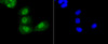 Immunofluorescence analysis of PANC-1 cells using Acetyl-TP53-K370 antibody (13-883) .