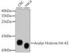 Western blot analysis of extracts of various cell lines, using Acetyl-Histone H4-K5 antibody (13-884) .<br/>Secondary antibody: HRP Goat Anti-Rabbit IgG (H+L) at 1:10000 dilution.<br/>Lysates/proteins: 25ug per lane.<br/>Blocking buffer: 3% nonfat dry milk in TBST.