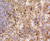 Immunohistochemistry of paraffin-embedded human spleen using Caspase 3 antibody (13-889) at dilution of 1:100 (40x lens) .