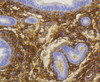 Immunohistochemistry of paraffin-embedded mouse uterus using NGFR antibody (13-894) at dilution of 1:100 (40x lens) .