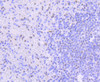 Immunohistochemistry of paraffin-embedded human spleen using PIM1 antibody (13-906) at dilution of 1:100 (40x lens) .