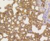 Immunohistochemistry of paraffin-embedded mouse lung using NF-kB p65 antibody (13-935) at dilution of 1:100 (40x lens) .