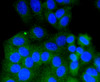 Immunofluorescence analysis of HepG2 cells using RAB9A antibody (13-975) .