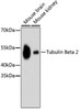 Western blot analysis of extracts of various cell lines, using Tubulin Beta 2 antibody (13-983) .<br/>Secondary antibody: HRP Goat Anti-Rabbit IgG (H+L) at 1:10000 dilution.<br/>Lysates/proteins: 25ug per lane.<br/>Blocking buffer: 3% nonfat dry milk in TBST.