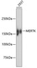 Western blot analysis of extracts of 293T cells, using MERTK antibody (13-990) .<br/>Secondary antibody: HRP Goat Anti-Rabbit IgG (H+L) at 1:10000 dilution.<br/>Lysates/proteins: 25ug per lane.<br/>Blocking buffer: 3% nonfat dry milk in TBST.