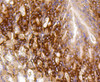 Immunohistochemistry of paraffin-embedded mouse stomach using BBC3 antibody (14-003) at dilution of 1:100 (40x lens) .