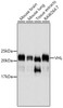 Western blot analysis of extracts of various cell lines, using VHL antibody (14-179) .<br/>Secondary antibody: HRP Goat Anti-Mouse IgG (H+L) (AS003) at 1:10000 dilution.<br/>Lysates/proteins: 25ug per lane.<br/>Blocking buffer: 3% nonfat dry milk in TBST.