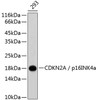 Western blot analysis of extracts of 293 cells, using CDKN2A / p16INK4a antibody (14-191) .<br/>Secondary antibody: HRP Goat Anti-Rabbit IgG (H+L) at 1:10000 dilution.<br/>Lysates/proteins: 25ug per lane.<br/>Blocking buffer: 3% nonfat dry milk in TBST.