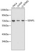 Western blot analysis of extracts of various cell lines, using SENP1 antibody (14-534) .<br/>Secondary antibody: HRP Goat Anti-Rabbit IgG (H+L) at 1:10000 dilution.<br/>Lysates/proteins: 25ug per lane.<br/>Blocking buffer: 3% nonfat dry milk in TBST.