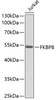 Western blot analysis of extracts of Jurkat cells, using FKBP8 antibody (14-576) .<br/>Secondary antibody: HRP Goat Anti-Rabbit IgG (H+L) at 1:10000 dilution.<br/>Lysates/proteins: 25ug per lane.<br/>Blocking buffer: 3% nonfat dry milk in TBST.