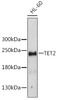 Western blot analysis of extracts of HL-60 cells, using TET2 antibody (16-519) .<br/>Secondary antibody: HRP Goat Anti-Rabbit IgG (H+L) at 1:10000 dilution.<br/>Lysates/proteins: 25ug per lane.<br/>Blocking buffer: 3% nonfat dry milk in TBST.