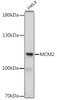 Western blot analysis of extracts of HeLa cells, using MCM2 antibody (16-522) .<br/>Secondary antibody: HRP Goat Anti-Rabbit IgG (H+L) at 1:10000 dilution.<br/>Lysates/proteins: 25ug per lane.<br/>Blocking buffer: 3% nonfat dry milk in TBST.