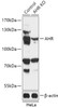 Western blot analysis of extracts from normal (control) and AHR knockout (KO) HeLa cells, using AHR antibody (18-223) at 1:1000 dilution.<br/>Secondary antibody: HRP Goat Anti-Rabbit IgG (H+L) at 1:10000 dilution.<br/>Lysates/proteins: 25ug per lane.<br/>Blocking buffer: 3% nonfat dry milk in TBST.<br/>Detection: ECL Basic Kit.<br/>Exposure time: 90s.
