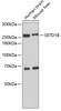 Western blot analysis of extracts of various cell lines, using SETD1B antibody (18-602) .<br/>Secondary antibody: HRP Goat Anti-Rabbit IgG (H+L) at 1:10000 dilution.<br/>Lysates/proteins: 25ug per lane.<br/>Blocking buffer: 3% nonfat dry milk in TBST.