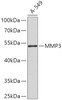 Western blot analysis of extracts of A-549 cells, using MMP3 antibody (18-643) .<br/>Secondary antibody: HRP Goat Anti-Rabbit IgG (H+L) at 1:10000 dilution.<br/>Lysates/proteins: 25ug per lane.<br/>Blocking buffer: 3% nonfat dry milk in TBST.