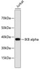 Western blot analysis of extracts of Jurkat cells, using IKB alpha antibody (18-655) .<br/>Secondary antibody: HRP Goat Anti-Rabbit IgG (H+L) at 1:10000 dilution.<br/>Lysates/proteins: 25ug per lane.<br/>Blocking buffer: 3% nonfat dry milk in TBST.