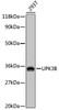 Western blot analysis of extracts of 293T cells, using UPK3B antibody (18-743) at dilution.<br/>Secondary antibody: HRP Goat Anti-Rabbit IgG (H+L) at 1:10000 dilution.<br/>Lysates/proteins: 25ug per lane.<br/>Blocking buffer: 3% nonfat dry milk in TBST.