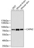 Western blot analysis of extracts of various cell lines, using CAPN2 antibody (18-761) .<br/>Secondary antibody: HRP Goat Anti-Rabbit IgG (H+L) at 1:10000 dilution.<br/>Lysates/proteins: 25ug per lane.<br/>Blocking buffer: 3% nonfat dry milk in TBST.