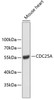 Western blot analysis of extracts of mouse heart, using CDC25A antibody (18-766) .<br/>Secondary antibody: HRP Goat Anti-Rabbit IgG (H+L) at 1:10000 dilution.<br/>Lysates/proteins: 25ug per lane.<br/>Blocking buffer: 3% nonfat dry milk in TBST.