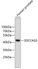 Western blot analysis of extracts of human prostate, using SDCCAG3 antibody (18-779) .<br/>Secondary antibody: HRP Goat Anti-Rabbit IgG (H+L) at 1:10000 dilution.<br/>Lysates/proteins: 25ug per lane.<br/>Blocking buffer: 3% nonfat dry milk in TBST.