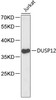 Western blot analysis of extracts of Jurkat cells, using DUSP12 antibody (18-789) .<br/>Secondary antibody: HRP Goat Anti-Rabbit IgG (H+L) at 1:10000 dilution.<br/>Lysates/proteins: 25ug per lane.<br/>Blocking buffer: 3% nonfat dry milk in TBST.