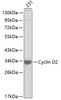 Western blot analysis of extracts of 231 cells, using Cyclin D2 antibody (18-853) .<br/>Secondary antibody: HRP Goat Anti-Rabbit IgG (H+L) at 1:10000 dilution.<br/>Lysates/proteins: 25ug per lane.<br/>Blocking buffer: 3% nonfat dry milk in TBST.