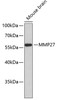 Western blot analysis of extracts of mouse brain, using MMP27 antibody (18-914) .<br/>Secondary antibody: HRP Goat Anti-Rabbit IgG (H+L) at 1:10000 dilution.<br/>Lysates/proteins: 25ug per lane.<br/>Blocking buffer: 3% nonfat dry milk in TBST.