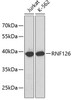 Western blot analysis of extracts of various cell lines, using RNF126 antibody (18-933) .<br/>Secondary antibody: HRP Goat Anti-Rabbit IgG (H+L) at 1:10000 dilution.<br/>Lysates/proteins: 25ug per lane.<br/>Blocking buffer: 3% nonfat dry milk in TBST.