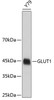 Western blot analysis of extracts of Y79 cells, using GLUT1 antibody (19-037) .<br/>Secondary antibody: HRP Goat Anti-Rabbit IgG (H+L) at 1:10000 dilution.<br/>Lysates/proteins: 25ug per lane.<br/>Blocking buffer: 3% nonfat dry milk in TBST.