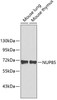 Western blot analysis of extracts of various cell lines, using NUP85 antibody (19-079) .<br/>Secondary antibody: HRP Goat Anti-Rabbit IgG (H+L) at 1:10000 dilution.<br/>Lysates/proteins: 25ug per lane.<br/>Blocking buffer: 3% nonfat dry milk in TBST.