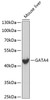 Western blot analysis of extracts of mouse liver, using GATA4 antibody (19-100) .