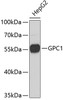 Western blot analysis of extracts of HepG2 cells, using GPC1 antibody (19-201) .<br/>Secondary antibody: HRP Goat Anti-Rabbit IgG (H+L) at 1:10000 dilution.<br/>Lysates/proteins: 25ug per lane.<br/>Blocking buffer: 3% nonfat dry milk in TBST.