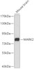 Western blot analysis of extracts of mouse brain, using MARK2 antibody (19-943) .<br/>Secondary antibody: HRP Goat Anti-Rabbit IgG (H+L) at 1:10000 dilution.<br/>Lysates/proteins: 25ug per lane.<br/>Blocking buffer: 3% nonfat dry milk in TBST.