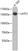 Western blot analysis of extracts of K-562 cells, using LATS1 antibody (22-749) .<br/>Secondary antibody: HRP Goat Anti-Rabbit IgG (H+L) at 1:10000 dilution.<br/>Lysates/proteins: 25ug per lane.<br/>Blocking buffer: 3% nonfat dry milk in TBST.