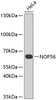 Western blot analysis of extracts of HeLa cells, using NOP56 antibody (23-363) .<br/>Secondary antibody: HRP Goat Anti-Rabbit IgG (H+L) at 1:10000 dilution.<br/>Lysates/proteins: 25ug per lane.<br/>Blocking buffer: 3% nonfat dry milk in TBST.
