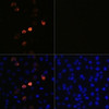 <strong>Figure 1 Immunofluorescence Validation of SARS-CoV-2 (COVID-19) Spike in HeLa cells</strong><br>
Immunofluorescence analysis of HeLa cells, untreated (right) and SARS-CoV-2 (COVID-19) spike plasmid transfected (left) using SARS-CoV-2 (COVID-19) spike antibody, 24-032, at 1:100 dilution. Blue: DAPI for nuclear staining.