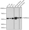 <strong>Figure 1 Western Blot Validation in Human Cell Lines and Mouse and Rat Tissues</strong><br>
Loading: 25 µg of lysates per lane. Antibodies: TMPRSS2 antibody, 24-034, at 1:1000 dilution. Secondary: Goat anti-rabbit IgG HRP conjugate at 1:10000 dilution. Blocking buffer: 3% nonfat dry milk in TBST.