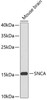 Western blot analysis of extracts of mouse brain, using SNCA antibody (13-004) .<br/>Secondary antibody: HRP Goat Anti-Rabbit IgG (H+L) at 1:10000 dilution.<br/>Lysates/proteins: 25ug per lane.<br/>Blocking buffer: 3% nonfat dry milk in TBST.