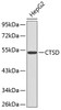 Western blot analysis of extracts of HepG2 cells, using CTSD antibody (13-013) .<br/>Secondary antibody: HRP Goat Anti-Rabbit IgG (H+L) at 1:10000 dilution.<br/>Lysates/proteins: 25ug per lane.<br/>Blocking buffer: 3% nonfat dry milk in TBST.