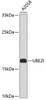 Western blot analysis of extracts of A2058 cells, using UBE2I antibody (13-034) .<br/>Secondary antibody: HRP Goat Anti-Rabbit IgG (H+L) at 1:10000 dilution.<br/>Lysates/proteins: 25ug per lane.<br/>Blocking buffer: 3% nonfat dry milk in TBST.