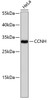 Western blot analysis of extracts of HeLa cells, using CCNH antibody (13-035) .<br/>Secondary antibody: HRP Goat Anti-Rabbit IgG (H+L) at 1:10000 dilution.<br/>Lysates/proteins: 25ug per lane.<br/>Blocking buffer: 3% nonfat dry milk in TBST.